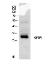 IGFBP1 Rabbit Polyclonal Antibody