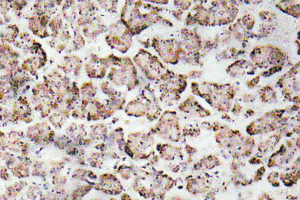 IGF-I Rabbit Polyclonal Antibody