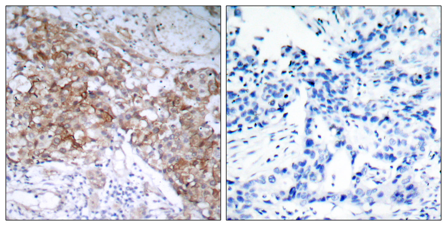 IGF-IR Rabbit Polyclonal Antibody