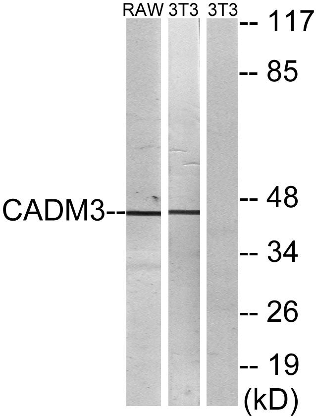 IGSF4B Rabbit Polyclonal Antibody