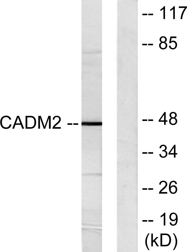 IGSF4D Rabbit Polyclonal Antibody