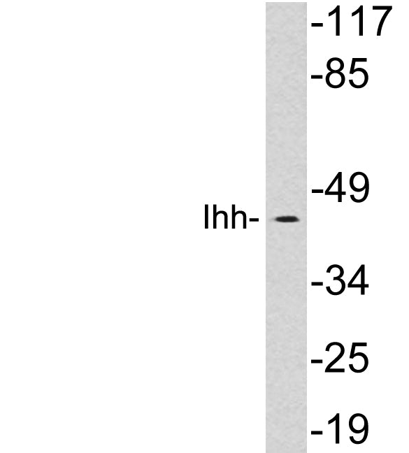 Ihh Rabbit Polyclonal Antibody