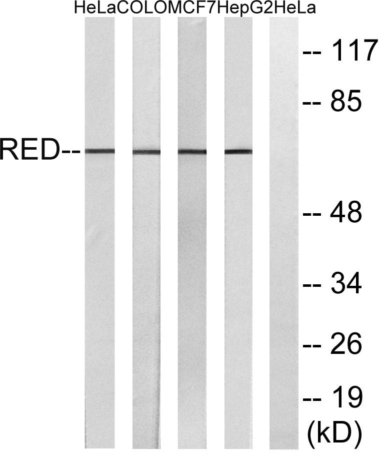 IK Rabbit Polyclonal Antibody