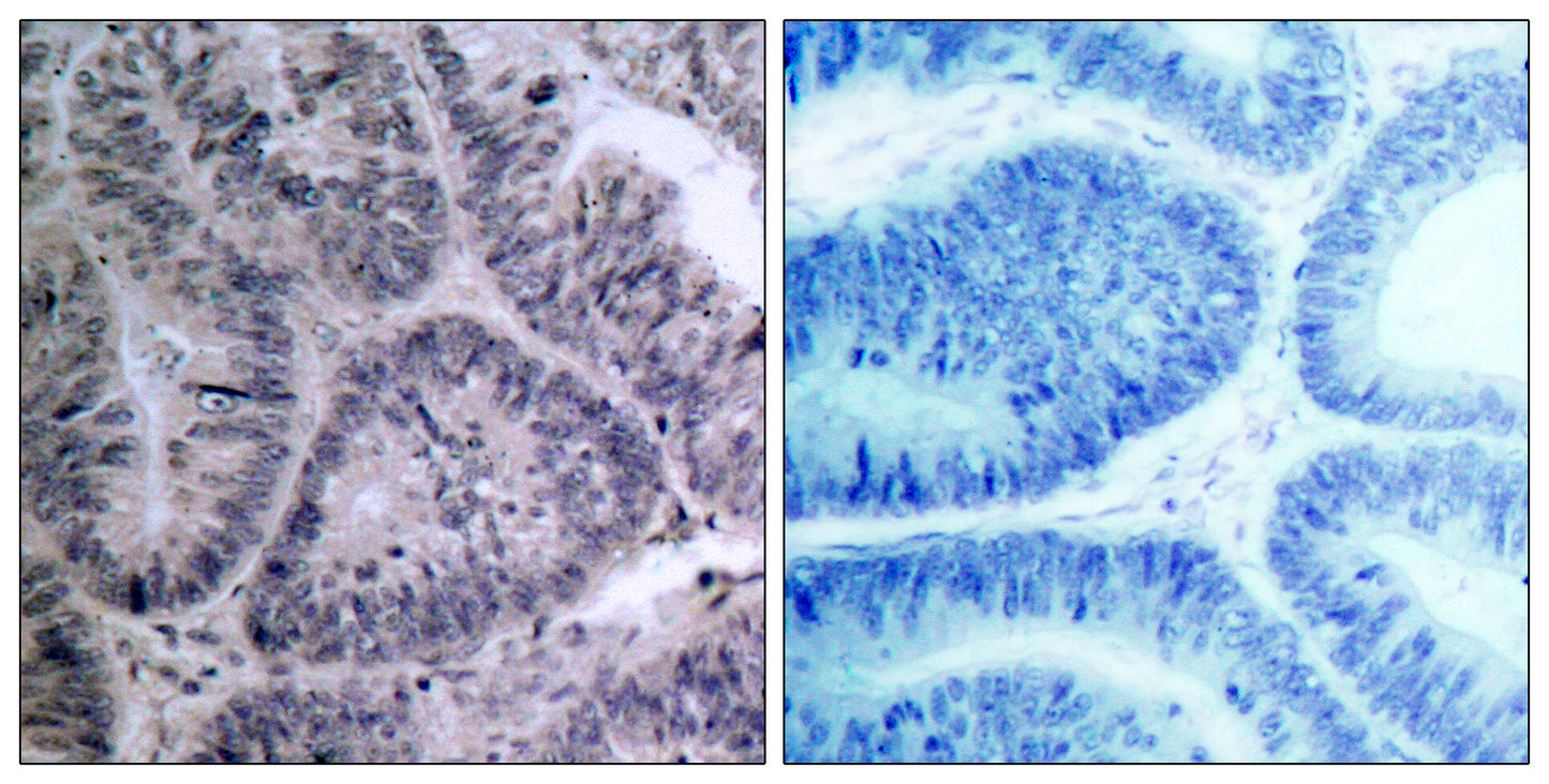 IKKα Rabbit Polyclonal Antibody