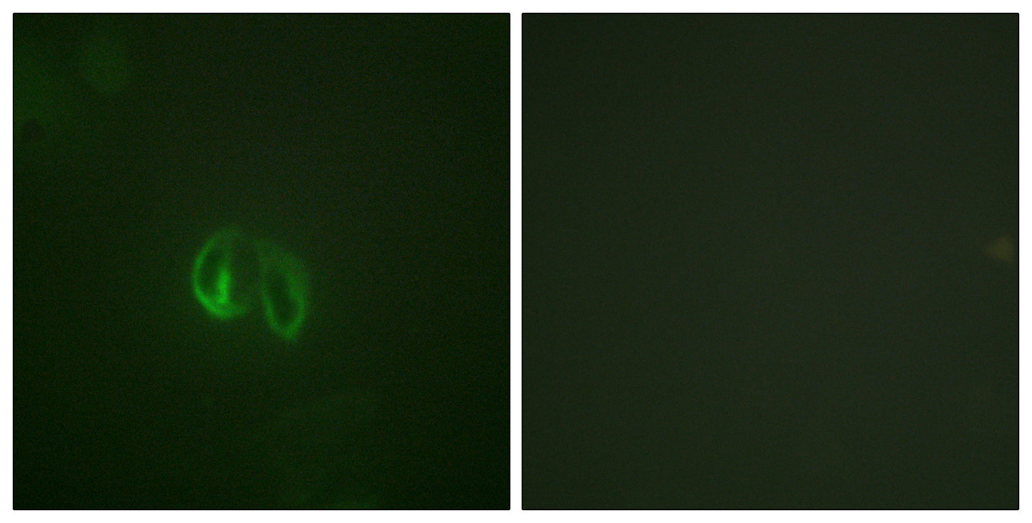 IL-10Rα Rabbit Polyclonal Antibody