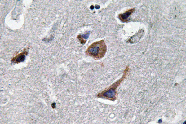 IL-12A Rabbit Polyclonal Antibody