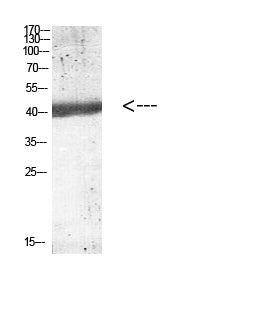 IL-12B p40 Rabbit Polyclonal Antibody