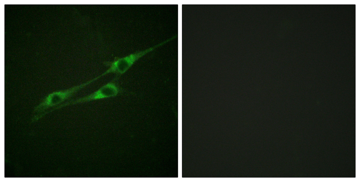 IL-13Rα1 Rabbit Polyclonal Antibody