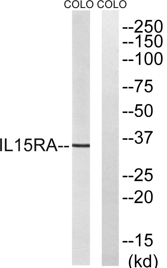 IL-15Rα Rabbit Polyclonal Antibody