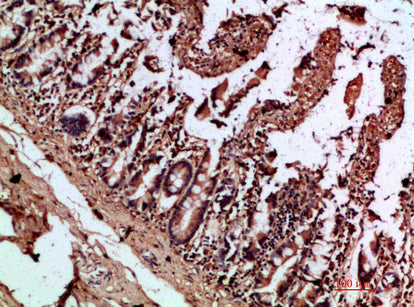 IL-17C Rabbit Polyclonal Antibody