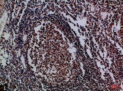 IL-17D Rabbit Polyclonal Antibody