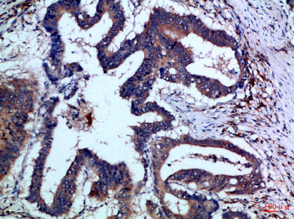 IL-17F Rabbit Polyclonal Antibody