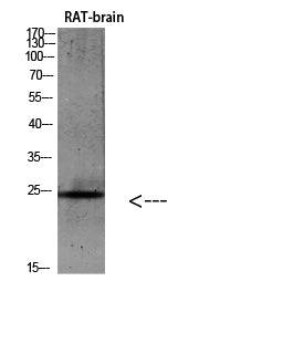 IL-19 Rabbit Polyclonal Antibody