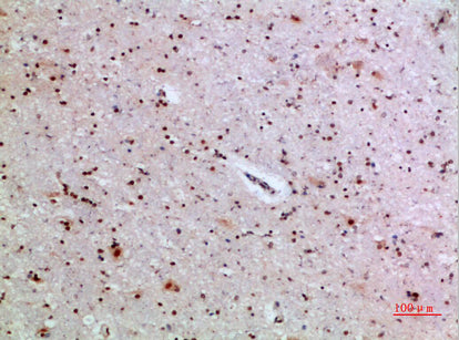 IL-1F6 Rabbit Polyclonal Antibody