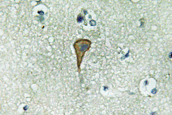 IL-20Rα Rabbit Polyclonal Antibody