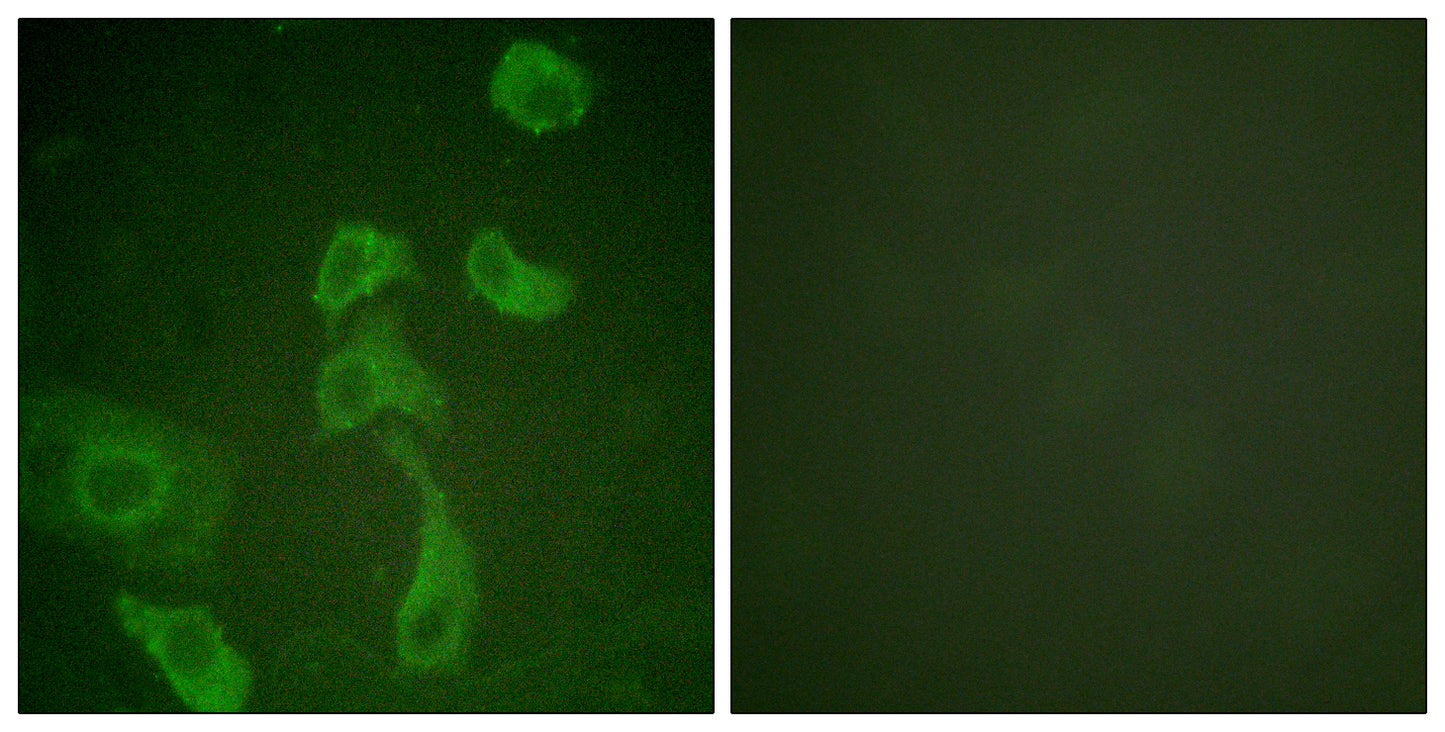 IL-2Rβ Rabbit Polyclonal Antibody