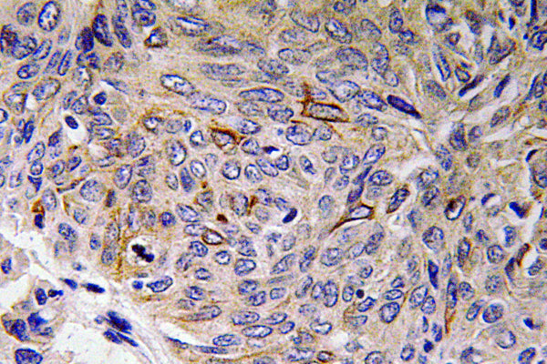 IL-32 Rabbit Polyclonal Antibody