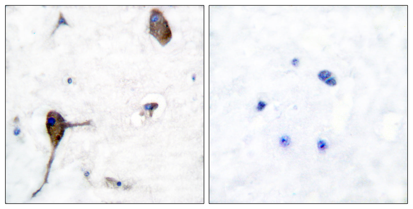 IL-3Rβ Rabbit Polyclonal Antibody