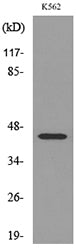 IL-5Rα Rabbit Polyclonal Antibody