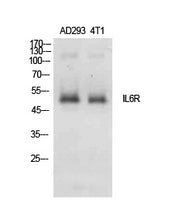 IL-6Rα Rabbit Polyclonal Antibody
