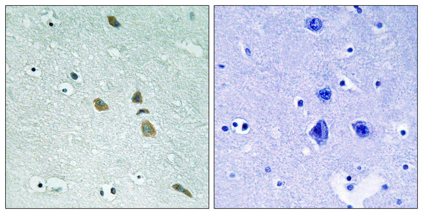 ILK Rabbit Polyclonal Antibody