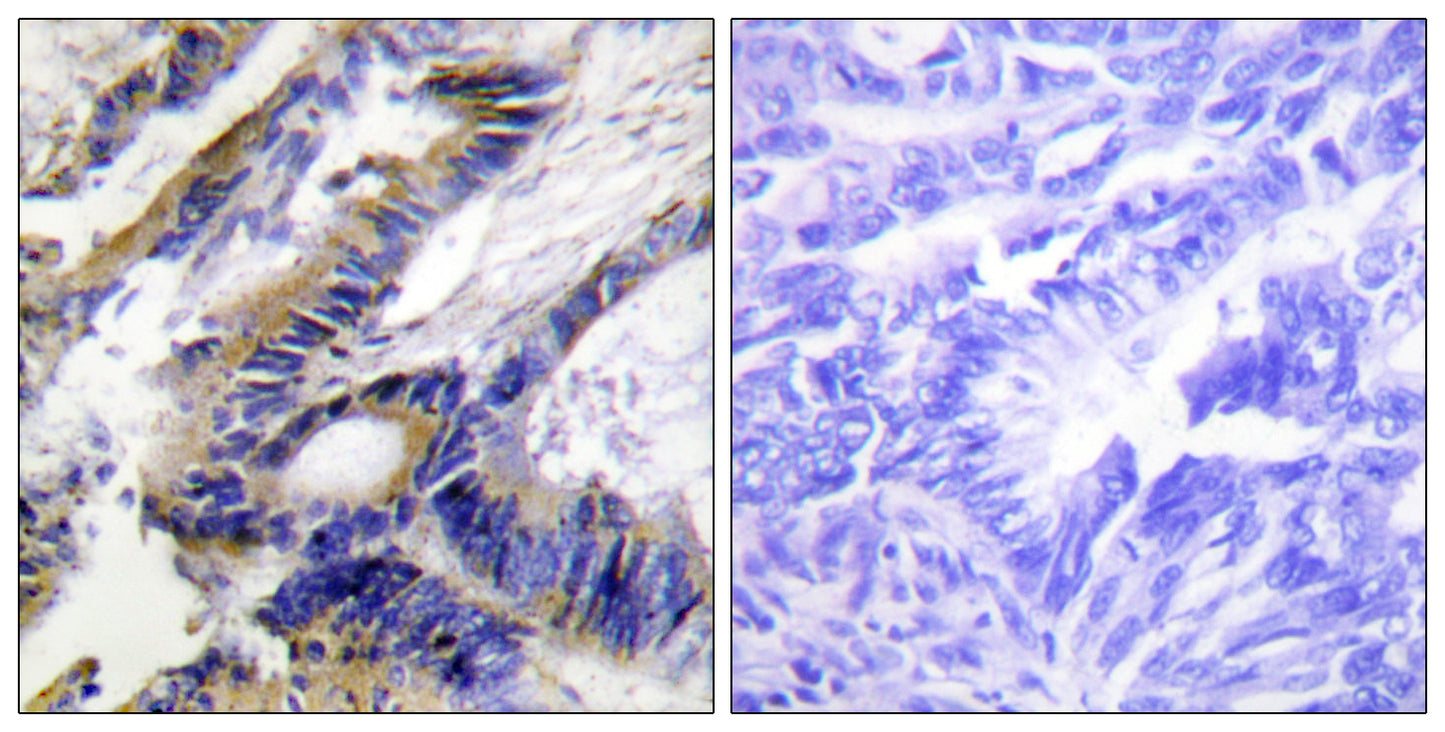 ILKAP Rabbit Polyclonal Antibody