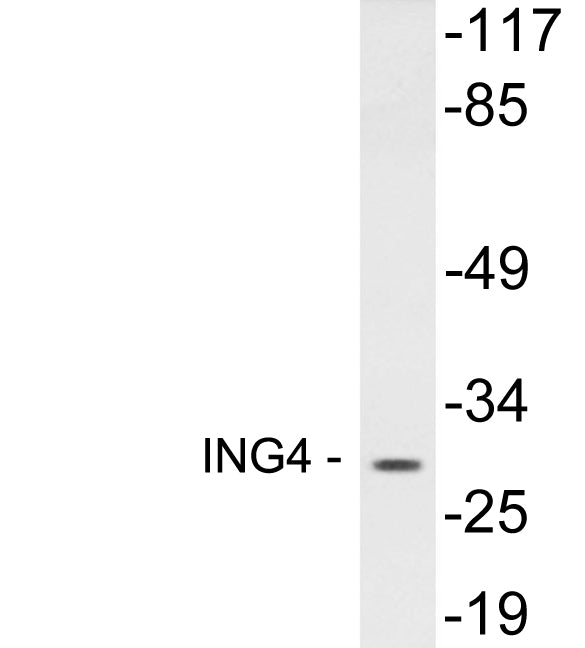 ING4 Rabbit Polyclonal Antibody