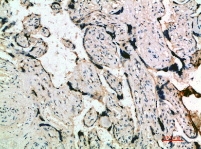 Inhibin α Rabbit Polyclonal Antibody