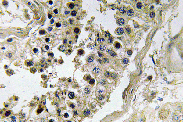 Inhibin β-C Rabbit Polyclonal Antibody