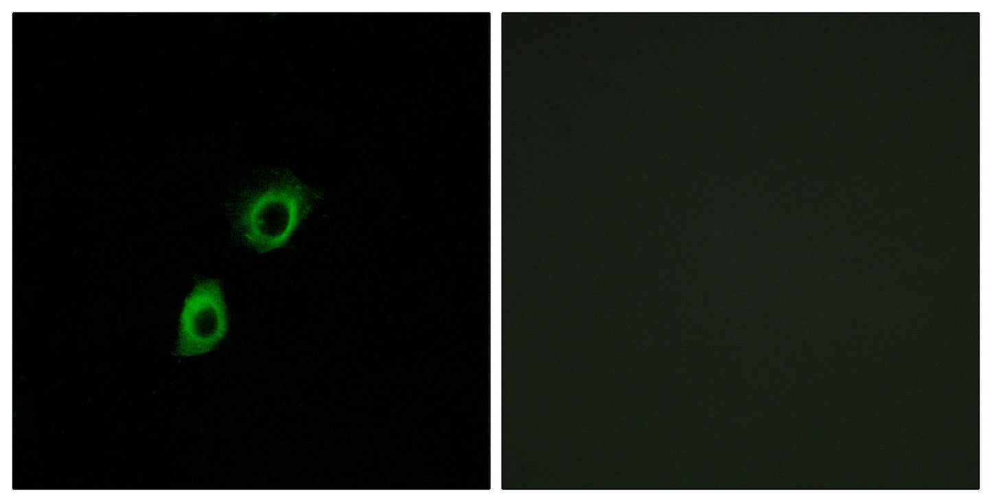 INSL4 Rabbit Polyclonal Antibody