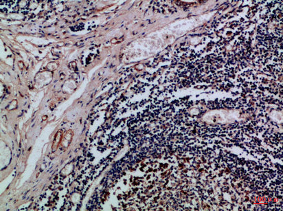Integrin αE Rabbit Polyclonal Antibody