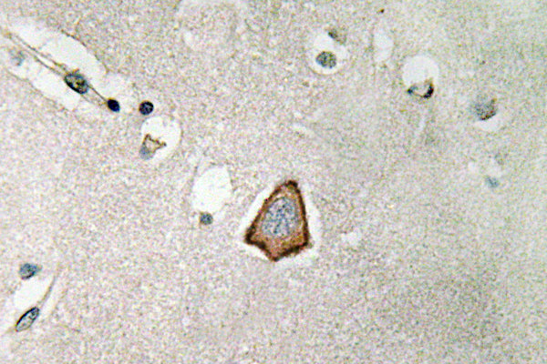 Integrin αV Rabbit Polyclonal Antibody