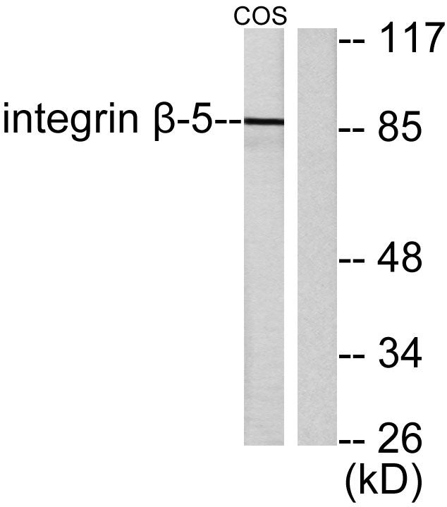 Integrin β5 Rabbit Polyclonal Antibody