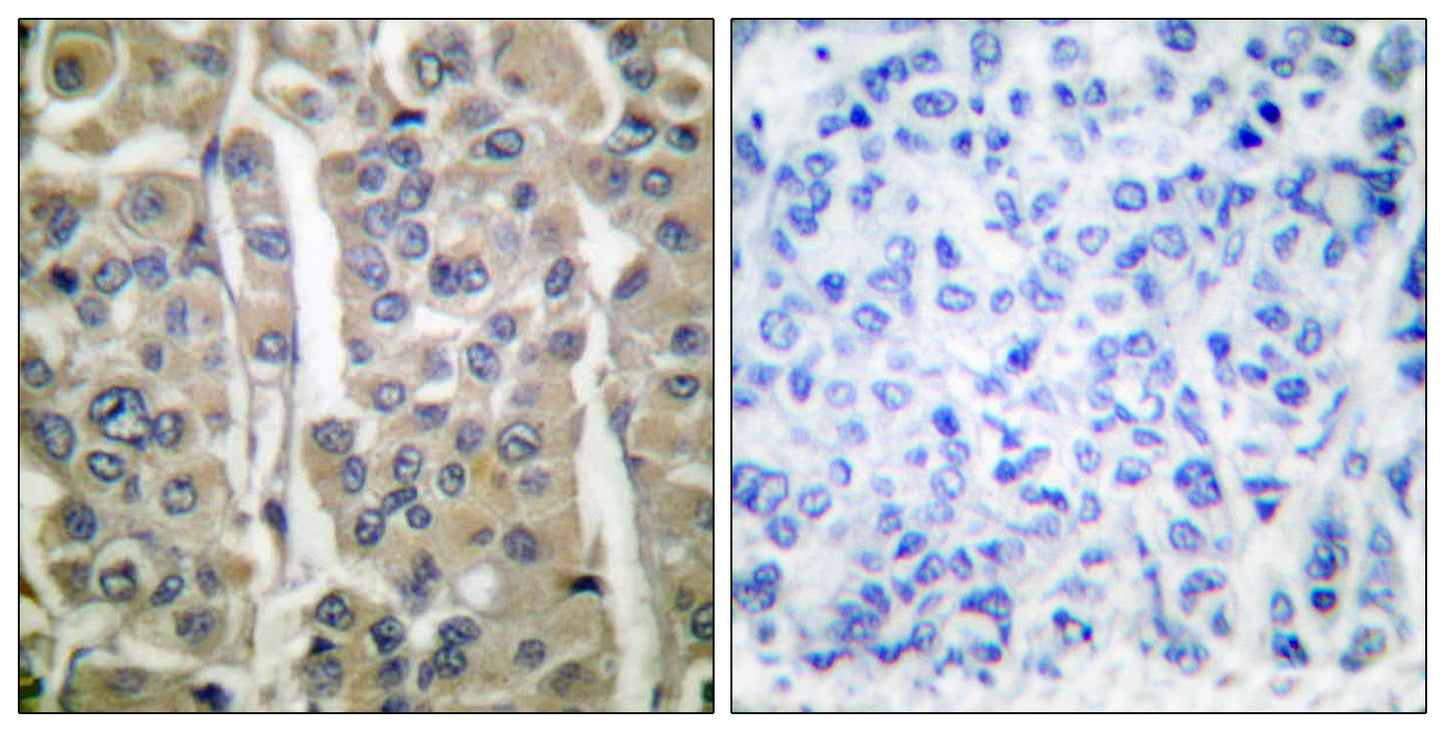 Involucrin Rabbit Polyclonal Antibody