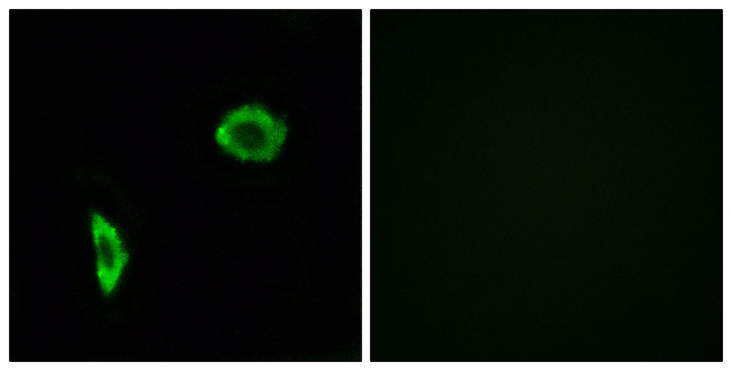 IP Receptor Rabbit Polyclonal Antibody