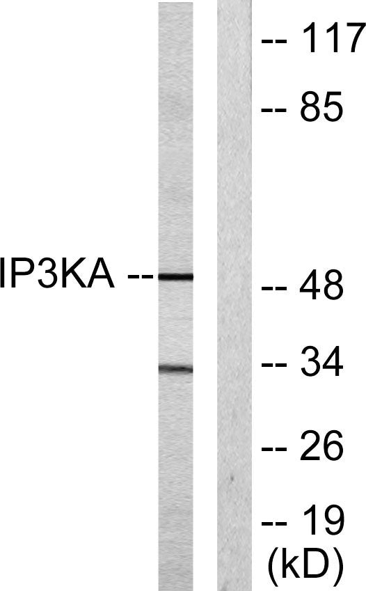 IP3KA Rabbit Polyclonal Antibody