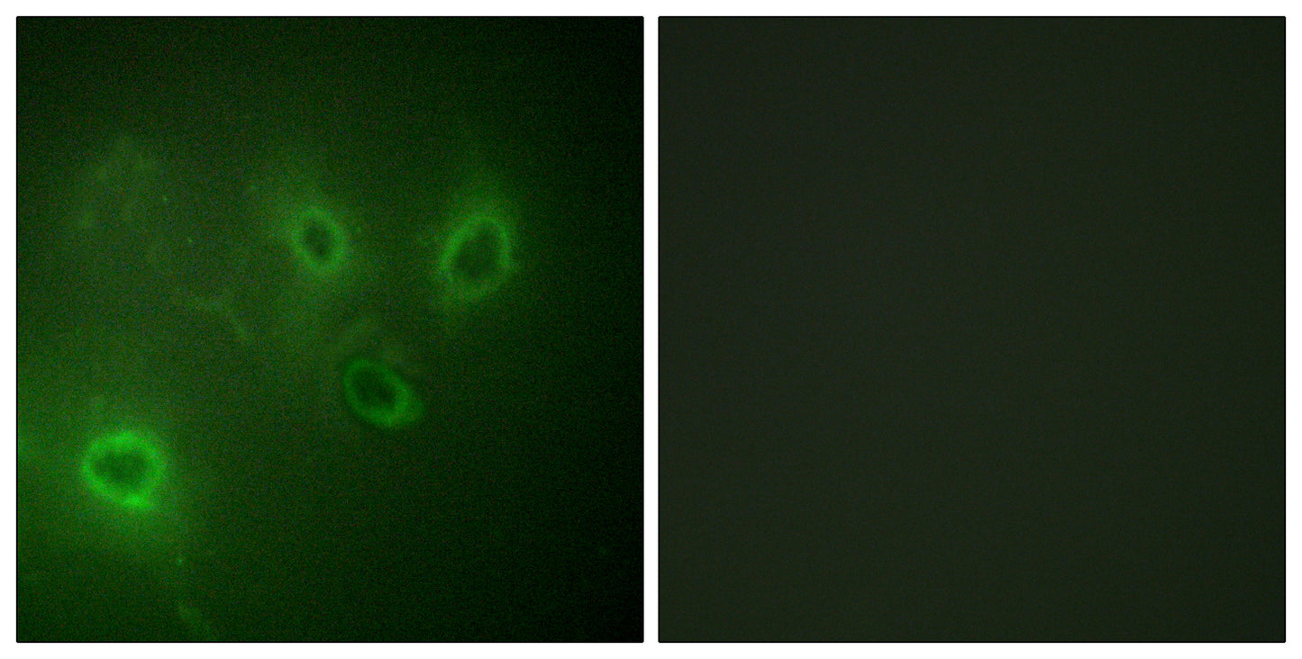 IP3R-I Rabbit Polyclonal Antibody
