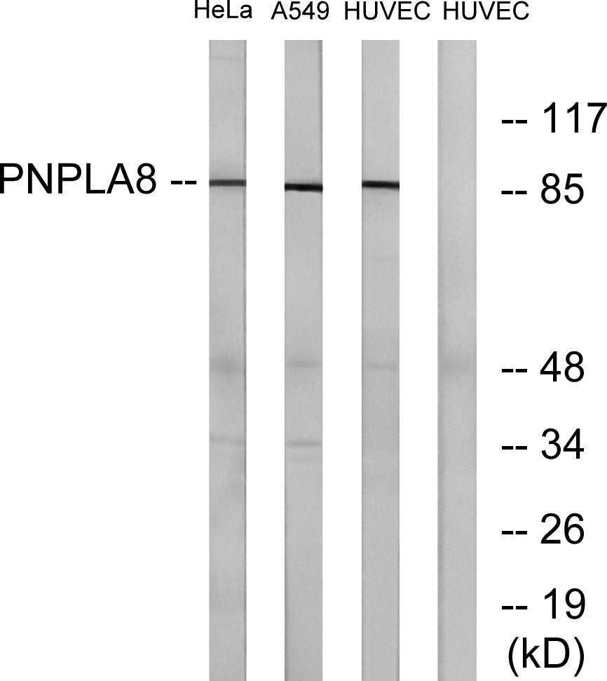 iPLA2γ Rabbit Polyclonal Antibody