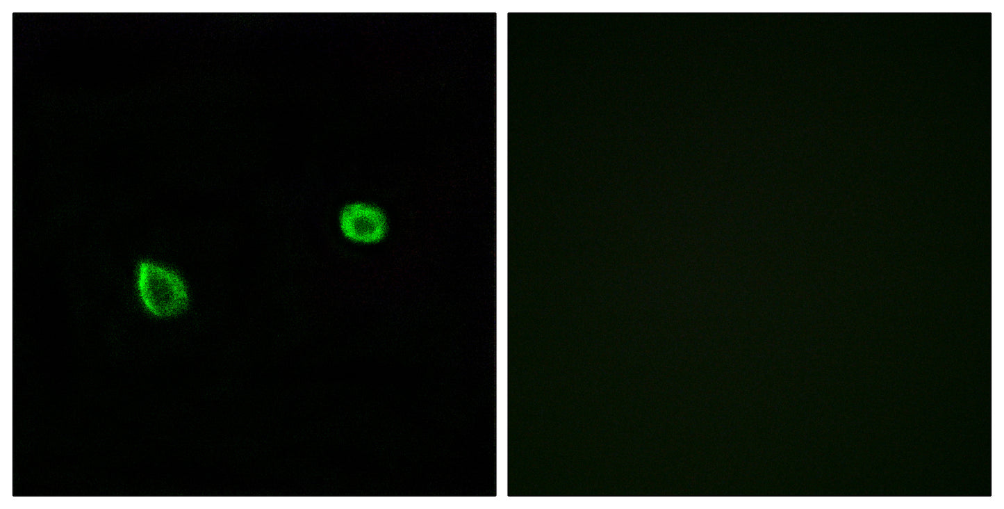 IRE1α/β Rabbit Polyclonal Antibody