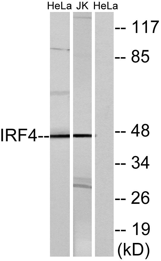 IRF-4 Rabbit Polyclonal Antibody