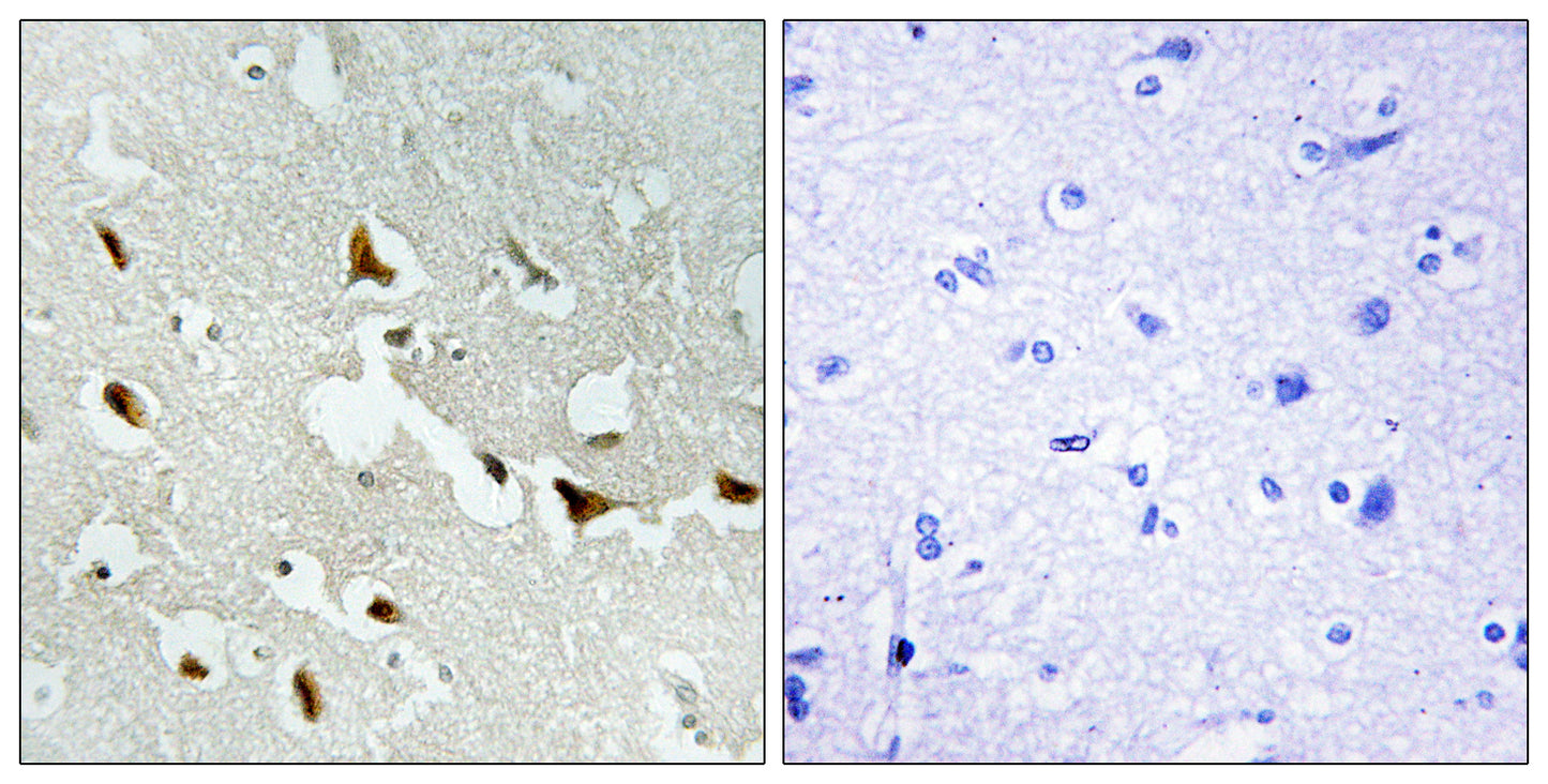 IRS-1 Rabbit Polyclonal Antibody