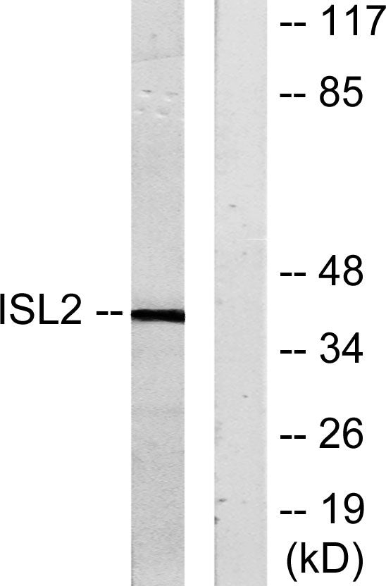 Islet-2 Rabbit Polyclonal Antibody