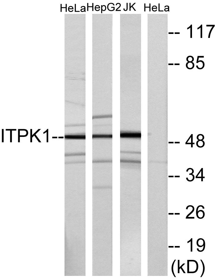 ITPK1 Rabbit Polyclonal Antibody