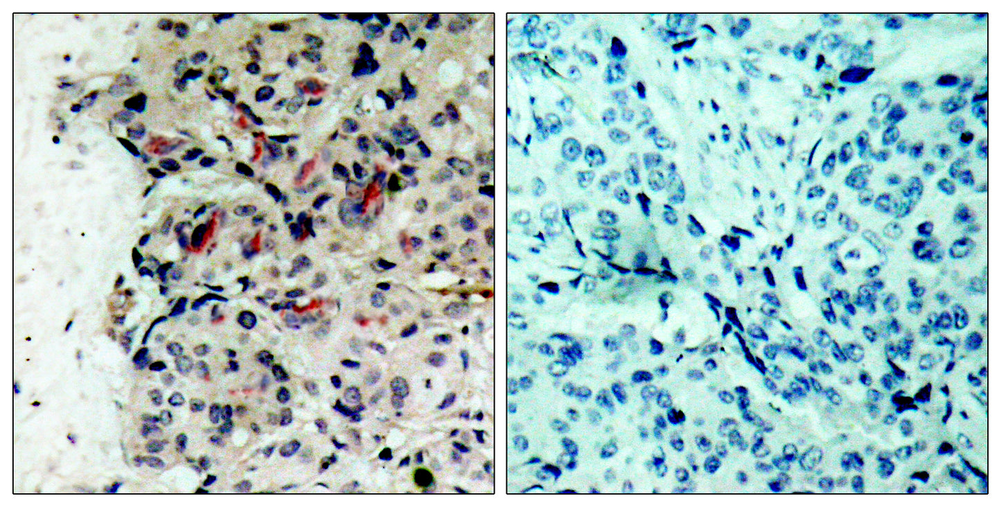 JAK1 Rabbit Polyclonal Antibody