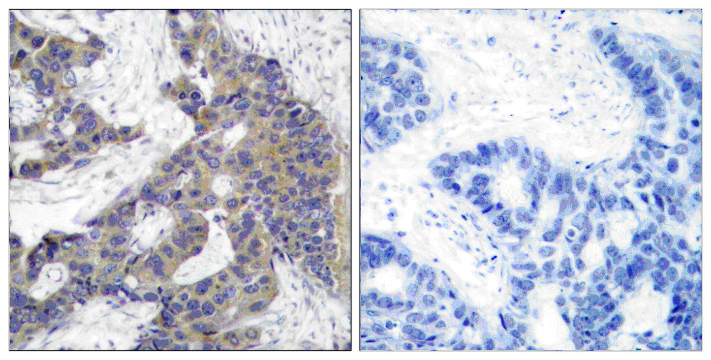 JAK2 Rabbit Polyclonal Antibody