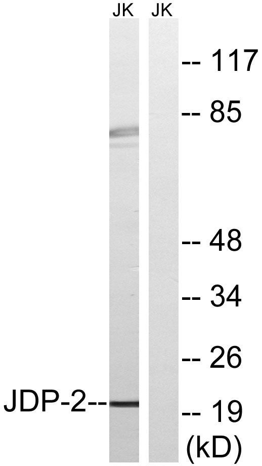 JDP2 Rabbit Polyclonal Antibody