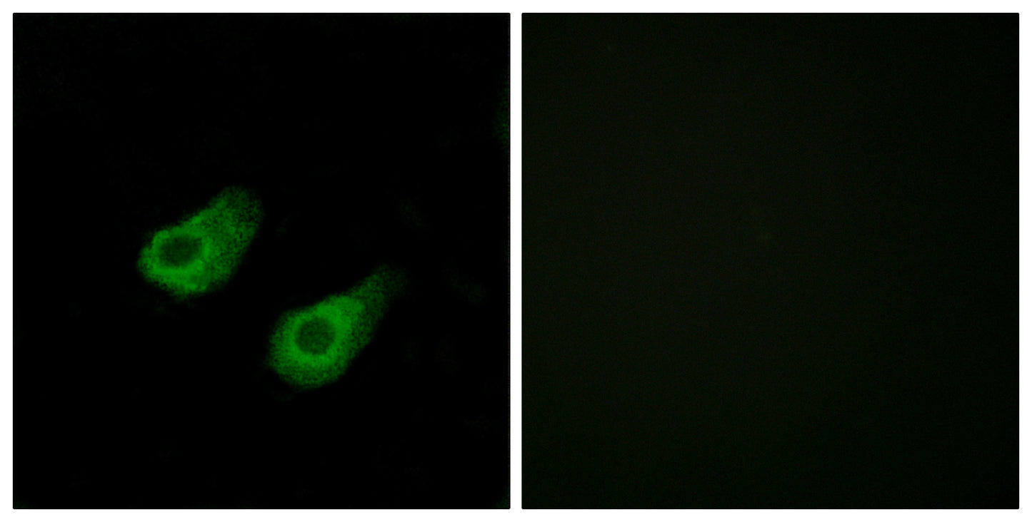 JIP-3 Rabbit Polyclonal Antibody