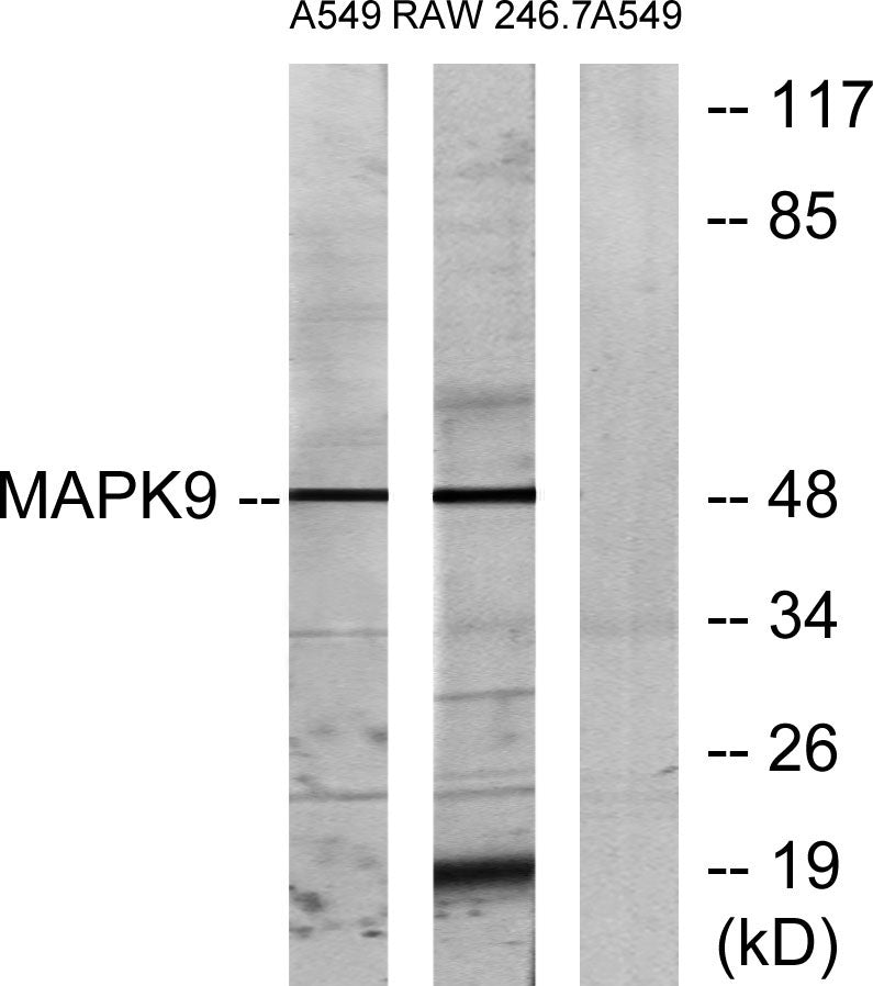 JNK2 Rabbit Polyclonal Antibody