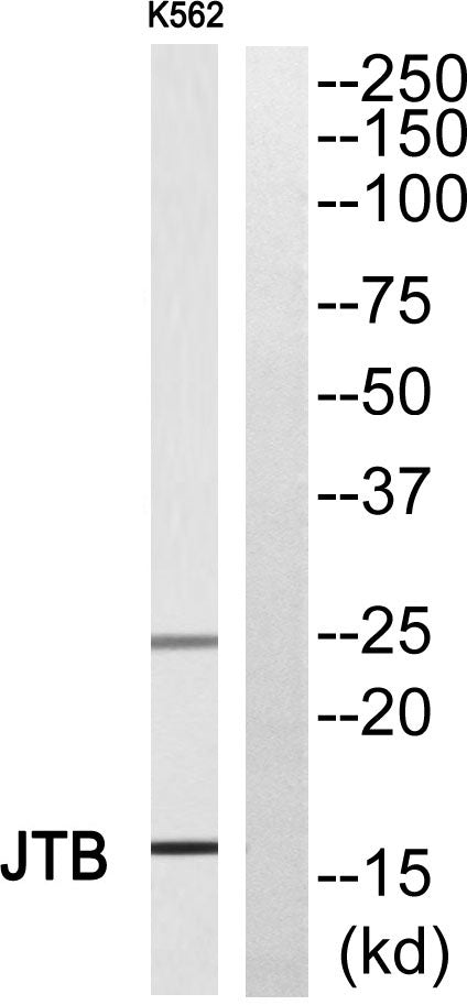 JTB Rabbit Polyclonal Antibody