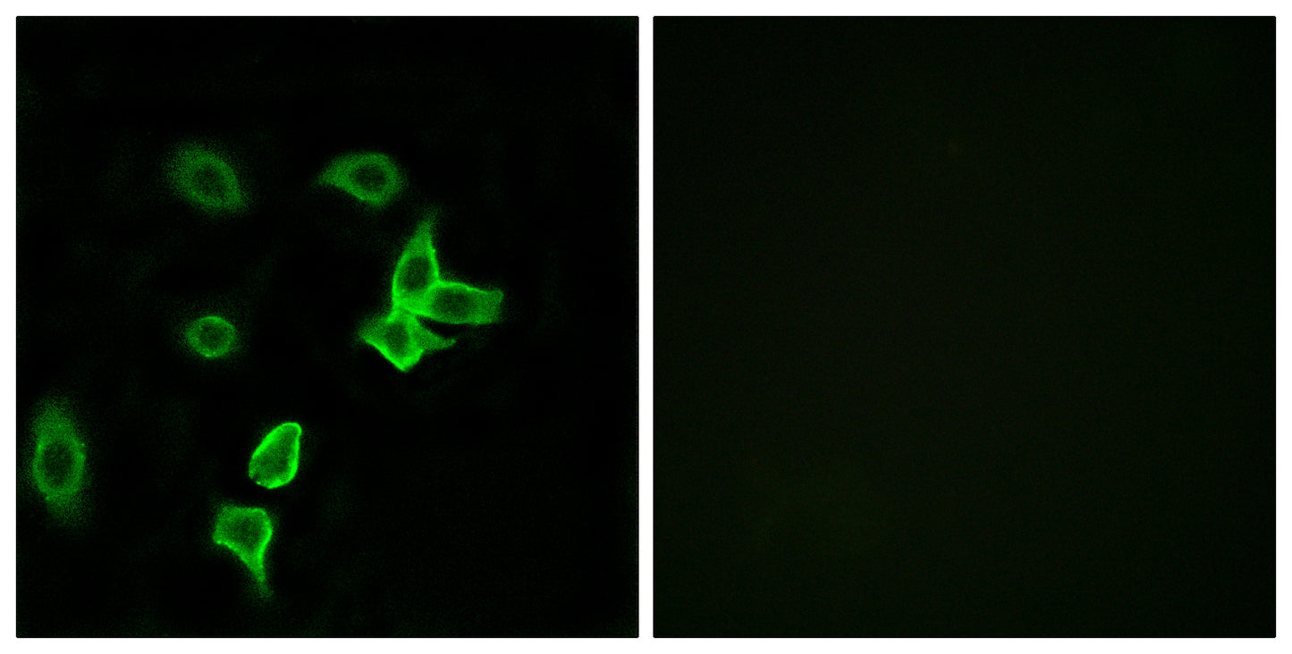 KANK2 Rabbit Polyclonal Antibody